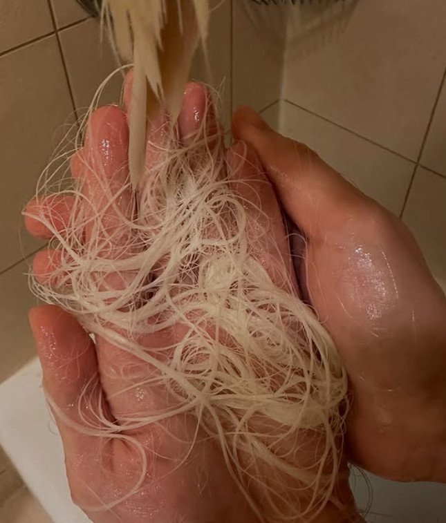 DJ 소다 "탈색 사고로 머리카락 녹아내려…한 주먹씩 빠져"