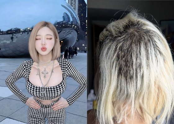 DJ 소다 탈색 사고로 머리카락 녹아내려…한 주먹씩 빠져 