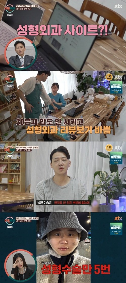 '다이어트 부부' 아내 성형수술 5번…안 고친 데 없어