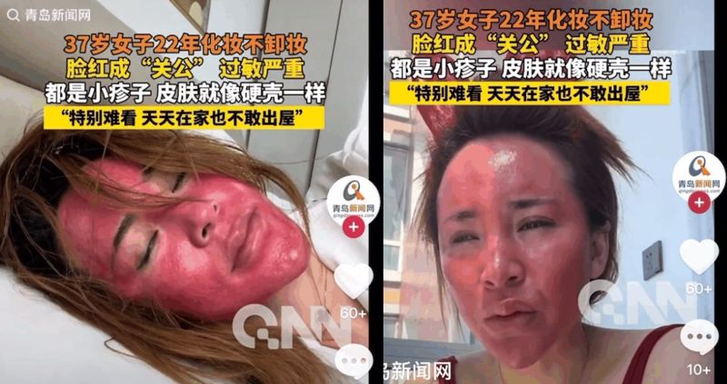 22년간 화장 안 지웠다는 30대女..심각하게 변한 얼굴 '충격'  