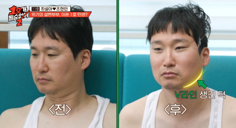 조현민♥최설아 "'1호'서 패션·성형 오픈…맘 편해졌죠" [코미디언을 만나다]①