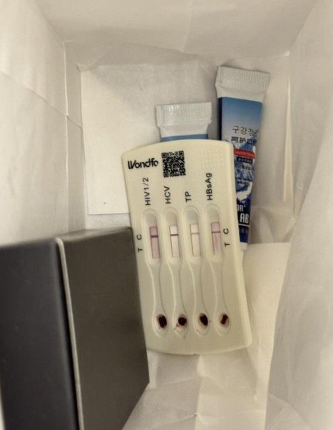 [서울=뉴시스]베이징의 한 고급 카지노 토토에서 혈흔이 남은 인간면역결핍바이러스(HIV) 자가진단 키트가 세면용품에서 발견돼 충격을 주고 있다.(사진=극목신문) *재판매 및 DB 금지