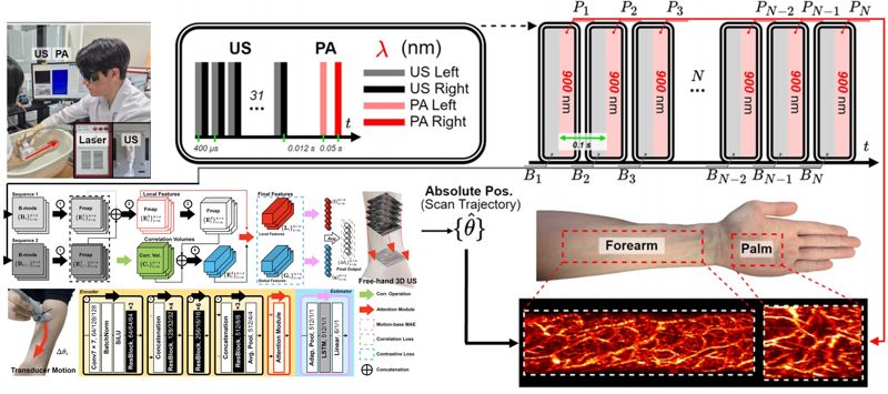 MRI 대신 초음파로...부산대, AI 기반 저비용 고정밀 3D 영상 구현