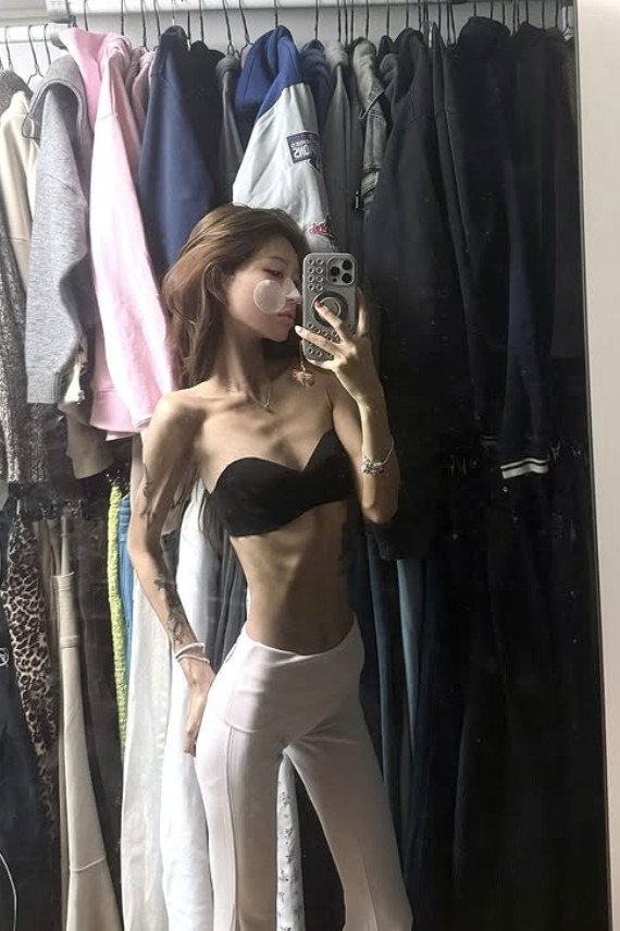 '96→41㎏' 최준희 골반 괴사 계속 진행 중…내 뼈 썩고 있다