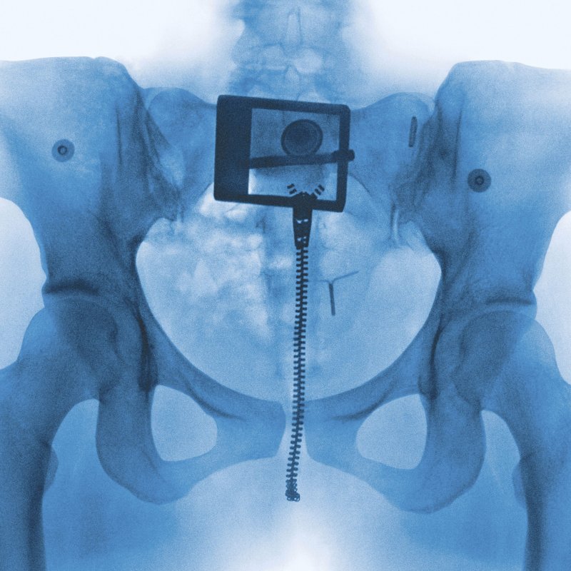 로드(Lorde), 가장 사적인 것이 가장 자랑스러우면서 가장 보편적인