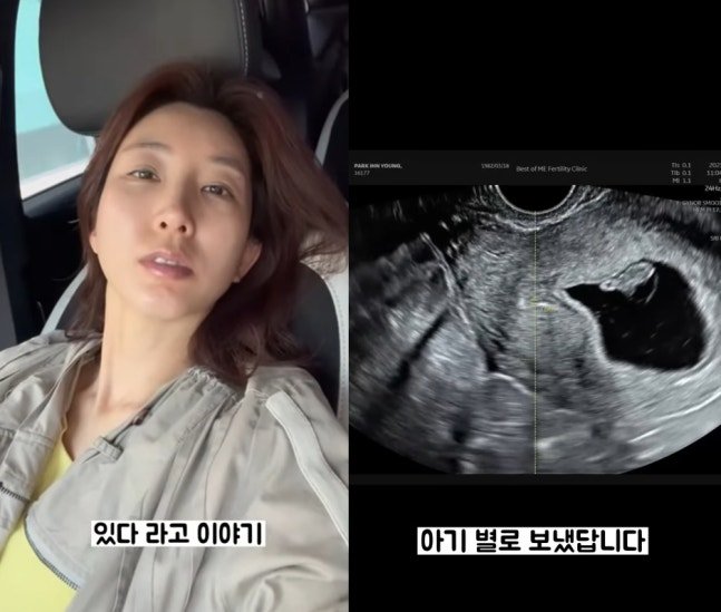 '이특 누나' 박인영, 유산 고백…"아기별로 보냈다"