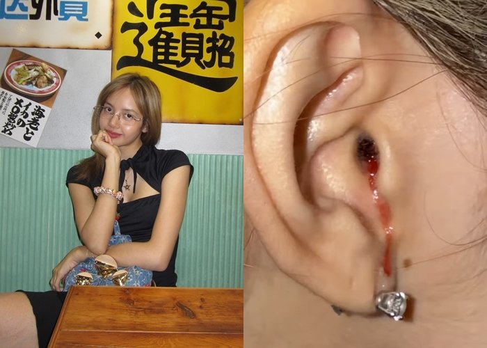 블랙핑크 리사, 귀에서 피가?…완전체 콘서트 앞두고 팬들 걱정