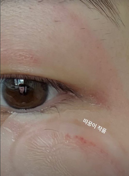 걸스데이 민아, 얼굴 상처 깜짝…"뭐 했냐고 물어보지 마"