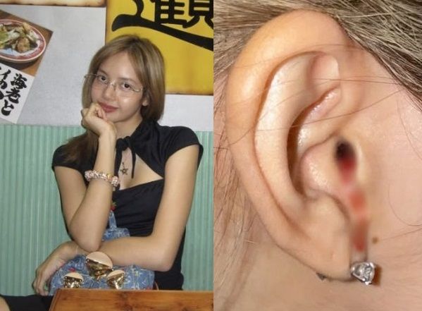 블랙핑크 리사, 귀에서 피 '철철'..日 여행 도중 무슨 일? [헬스톡]