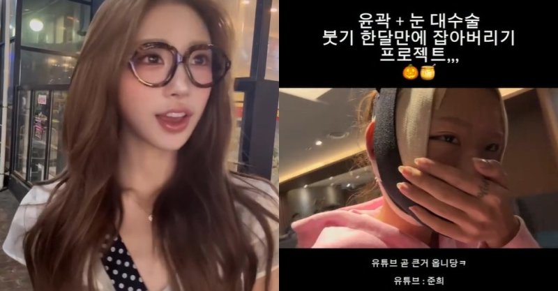 최준희, 퉁퉁 부은 얼굴에 붕대 칭칭 "윤곽+눈 대수술…"