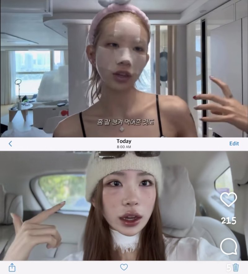 최준희, 광대&middot;눈 성형 후 달라진 얼굴…인형 미모