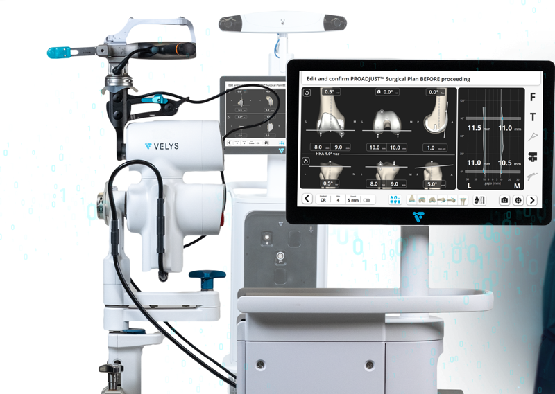 인공관절 수술 로봇 벨리스. 안양윌스기념병원 제공
