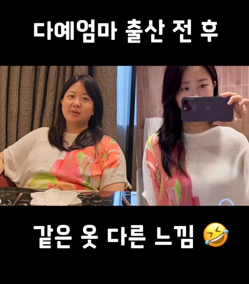 '박수홍 아내' 김다예, 30㎏ 감량…출산 전후 같은 사람 맞아? [N샷]