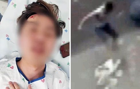 아내 때리던 남편, 지나가던 고3에게 개XX 욕하더니...