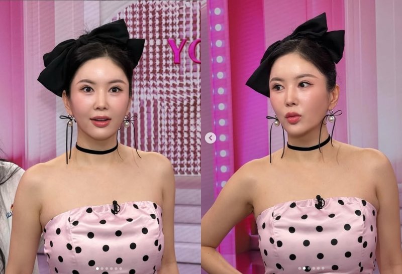 장영란, 4번째 눈성형 후 물오른 미모