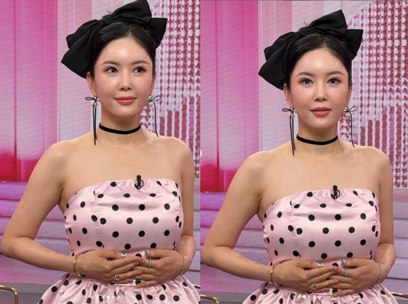 장영란, 4번째 눈성형 후 물오른 미모