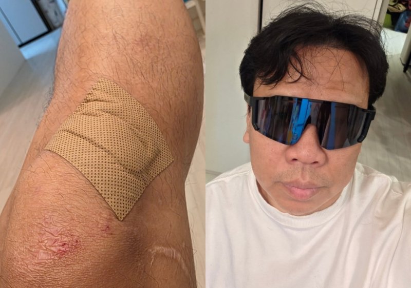 미끄러져 핸들 놓쳤다…오지헌, 빗길 낙차사고에 부상 '아찔'