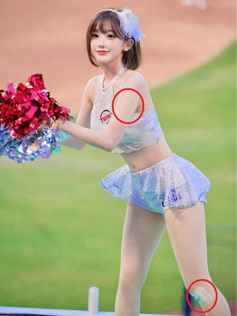 파스 붙이고.. 이주은, 안쓰러운 상처