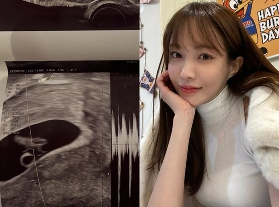 '임신' 서민재 아이 친부, 여전히 연락 없어…책임·도리 외면