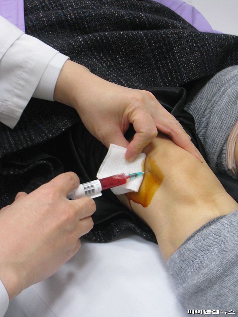 한 의사가 환자에게 혈소판 신규 바카라사이트 혈장 주사 신규 바카라사이트를 하고 있다. 연세사랑병원 제공