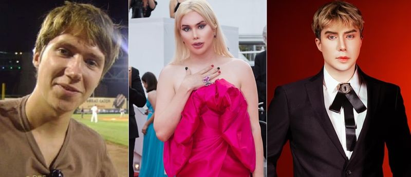 한국 아이돌처럼 되고 싶다…두 번의 성전환 수술 가능할까