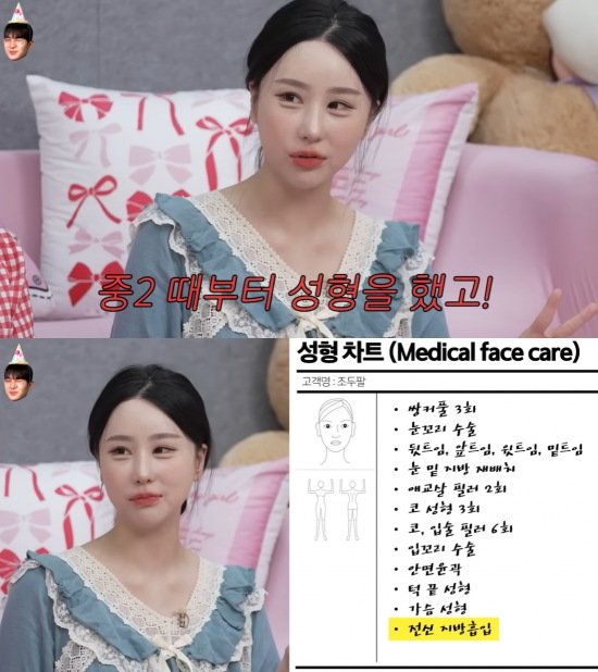 조두팔 "중2때부터 성형…수술비만 1억 들었다"