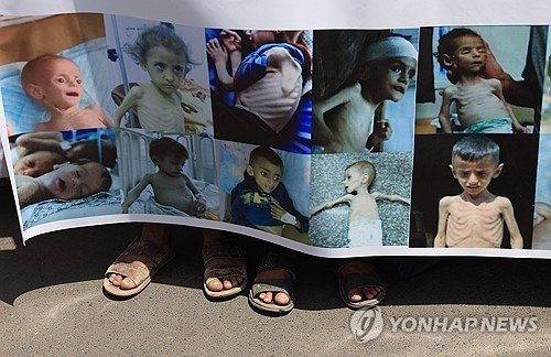 예멘 시위대가 들고 나온 기아 상태 가자 어린이들 사진 (출처=연합뉴스)