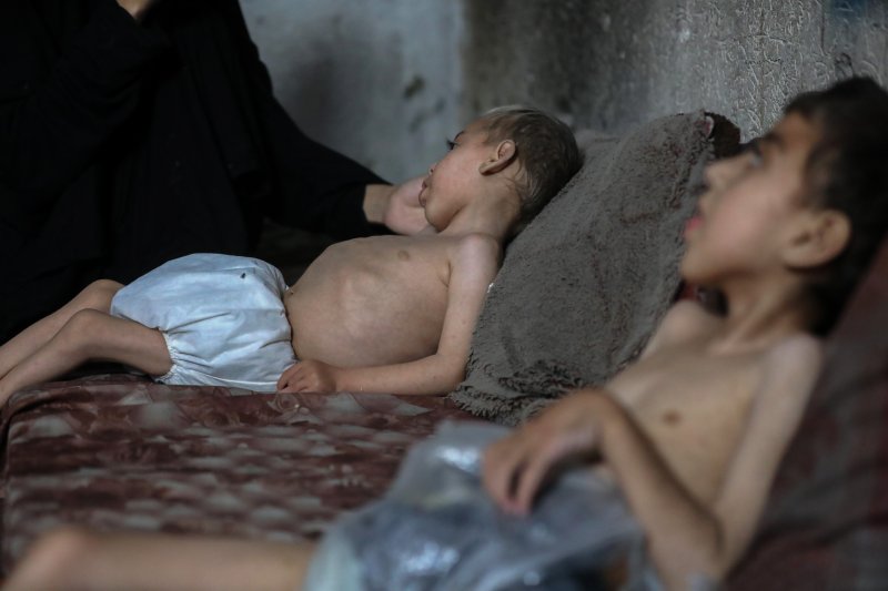 [가자시티=신화/뉴시스] 지난 25일(현지 시간) 가자지구 가자시티의 한 대피소에서 영양실조와 뇌성마비로 고통받는 팔레스타인 어린이들이 누워 있는 모습. 2025.07.27.