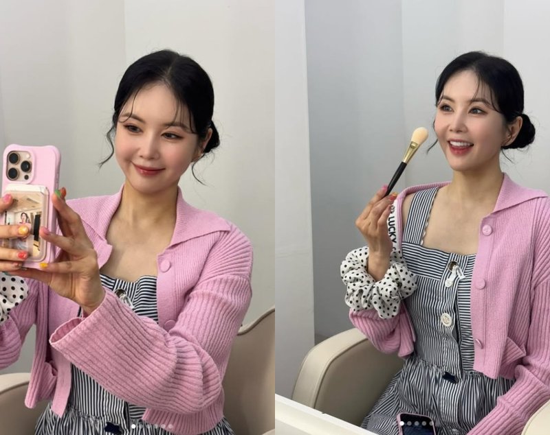 장영란, 4번째 눈성형 후 놀라운 미모…인형 같아