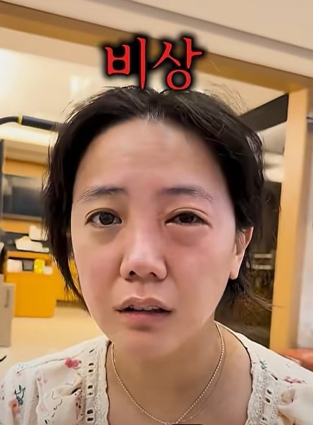 고은아, 안타까운 얼굴…"역대급 알러지"