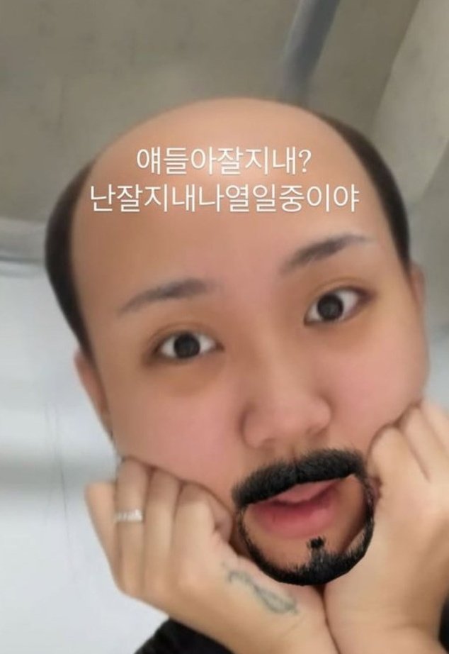 이영지, 사진 한 장에 팬 4000명 떠났다