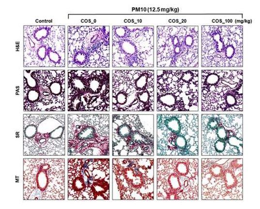 동물 모델에서의 폐 섬유화 증상 감소. 아미코젠 제공.