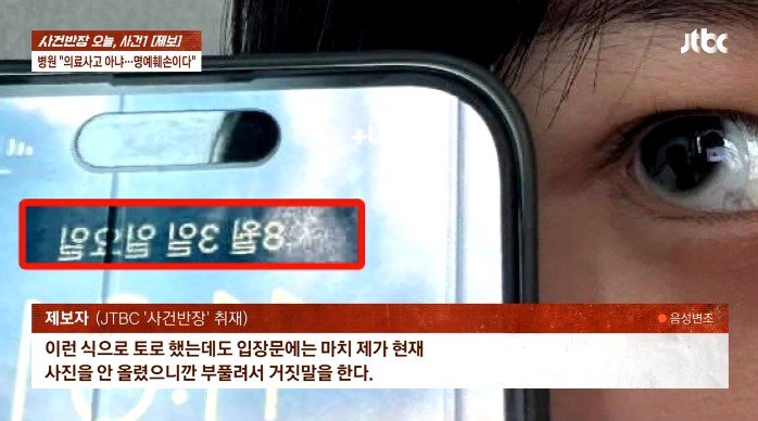 "두 눈이..." 성형수술 후 끔찍한 부작용에 절망한 여성