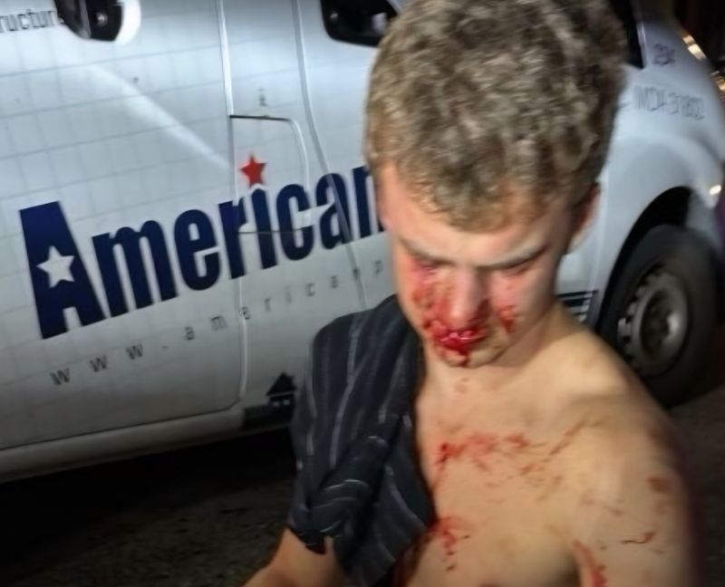 집단폭행을 당한 에드워드 코리스틴의 사진. 도널드 트럼프 미국 대통령이 트루스소셜에 게재했다. 코리스틴은 현재 정부효율부(DOGE) 소속 소프트웨어 엔지니어로 일하고 있다.트루스소셜 캡처