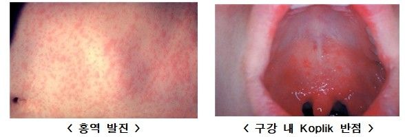 /사진=질병관리청 제공