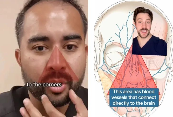 여드름 짰다가 죽을 뻔…'죽음의 삼각형' 어디길래?