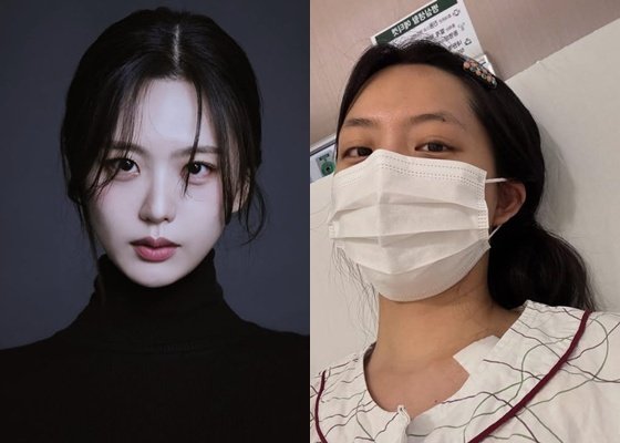 '걸그룹 출신 배우' 류지원, 백혈병 투병 중 깊은 수렁 빠져…머리카락도 없어