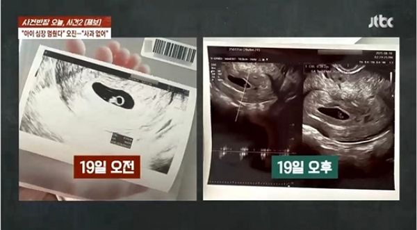 살아 있는 아기 죽일 뻔 해놓고 의사 하는 말이... 황당