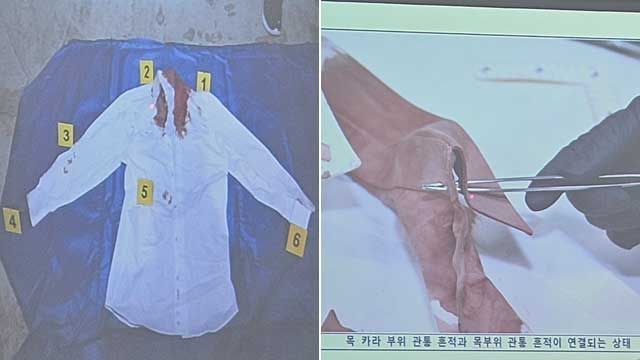 이재명 대통령이 당 대표 시절이던 지난해 1월 피습당시에 입었던 와이셔츠에 혈흔이 묻어 있다. 옷깃 부분에 길이 1.5cm, 내부 옷감에 길이 1.2cm 크기의 구멍이 뚫렸다. 국회 제공