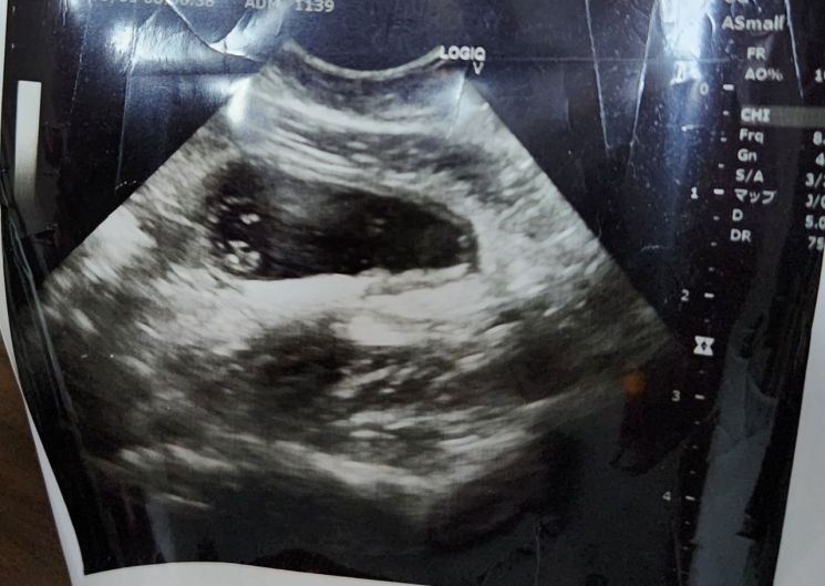 "태아 초음파 사진 팝니다" 日 중고거래 플랫폼에 올라온 가격이…