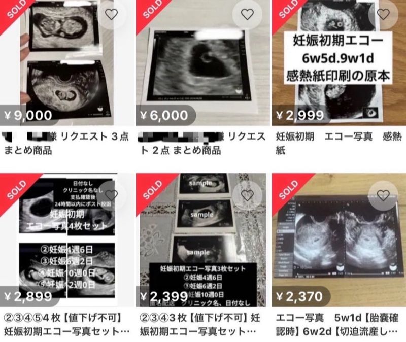태아 초음파 사진 팝니다 日 중고거래 플랫폼에 올라온 가격이…
