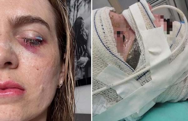 30대女 진통제 복용했다가…시력 손실까지  