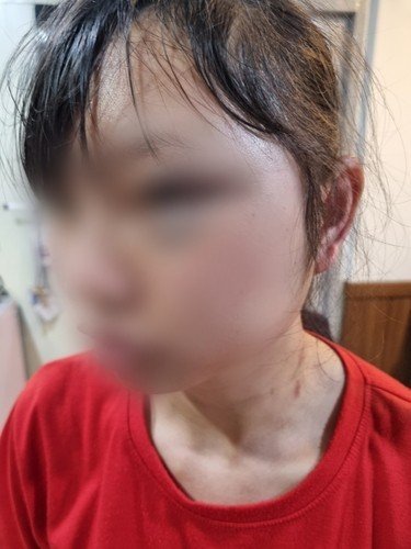 女이주노동자 얼굴 발로 걷어차 멍투성이 만든 40대男 최후