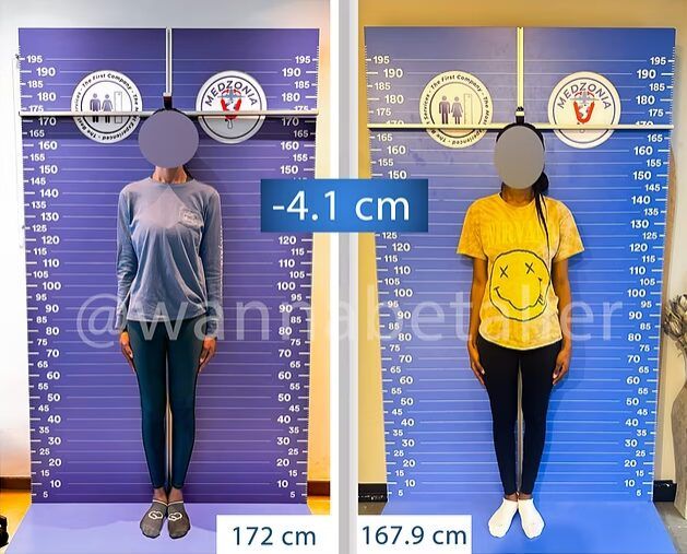 "남친 사귀고 싶어"…'위험천만' 이 수술까지 받는 여성들