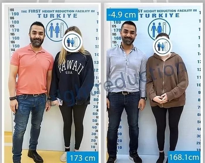 남친 사귀고 싶어…'위험천만' 이 수술까지 받는 여성들