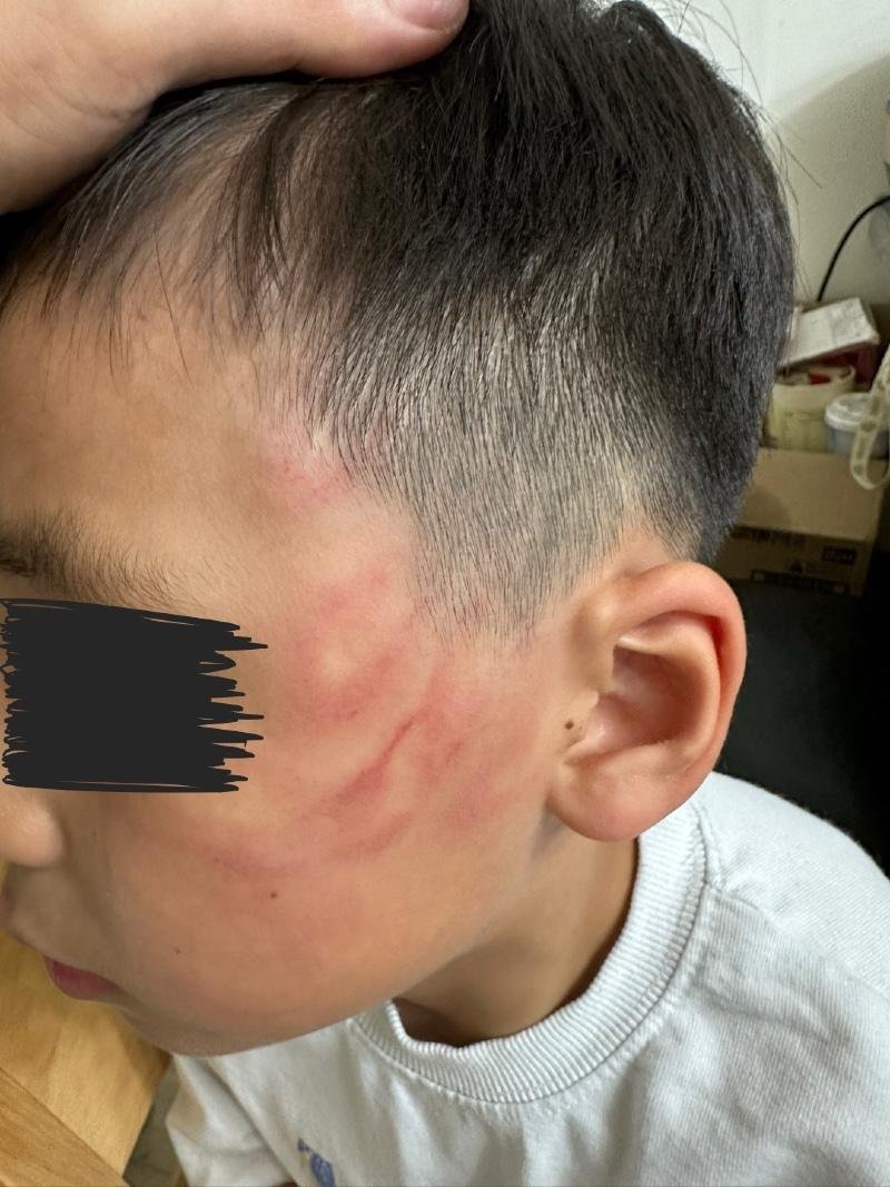 "관장에게 맞았다" 아동학대 의혹..CCTV로 드러난 '반전'