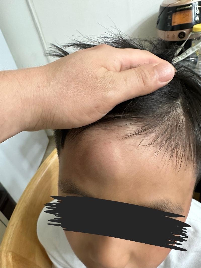 "관장에게 맞았다" 아동학대 의혹..CCTV로 드러난 '반전'