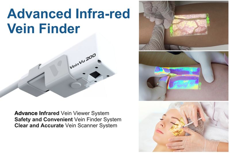마쥬텍의 정맥 뷰어 VeinVu 200. 원주의료기기산업진흥원 제공