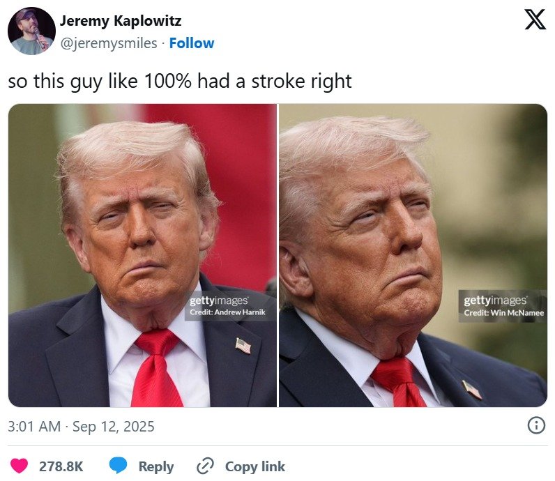 뇌졸중 아냐?…트럼프 '비뚤어진 입'에 미국인들 깜짝