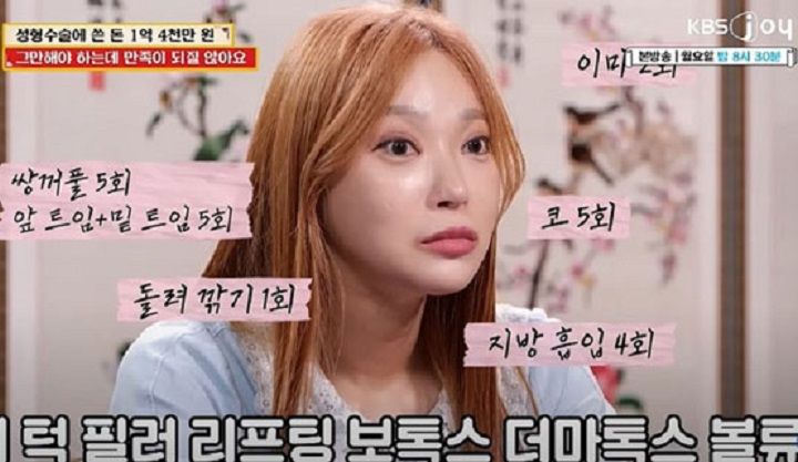 성형에 1억4000만원 썼는데... 30대 여성의 사연